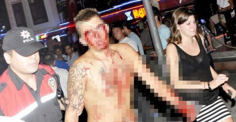 Turistlerin eğlenceli gecesi kanlı bitti - Resim: 3