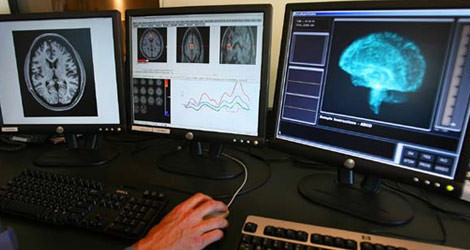 Beynimiz hakkındaki gerçekler - Resim: 1