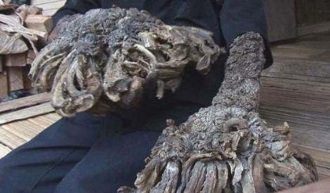 Dev bacaklı kadın - Resim: 4