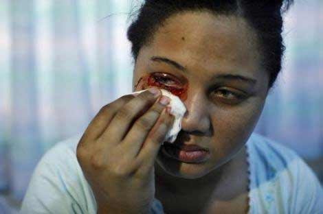 Stres bakın ne yaptı! - Resim: 2