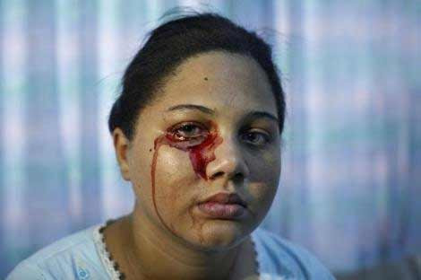 Stres bakın ne yaptı! - Resim: 4