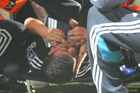 Beşiktaşlı futbolcunun ayağı kırıldı  - Resim: 1