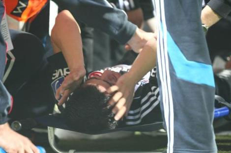 Beşiktaşlı futbolcunun ayağı kırıldı  - Resim: 2