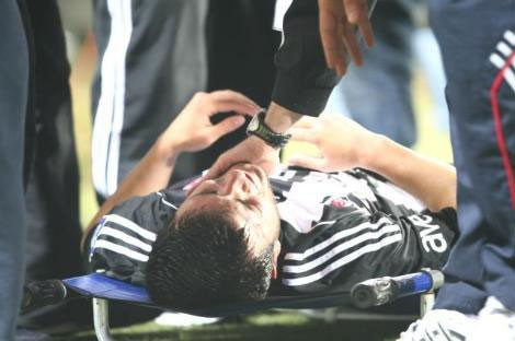 Beşiktaşlı futbolcunun ayağı kırıldı  - Resim: 3