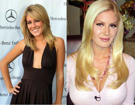 Bir günde 10 estetik ameyilat yaptırınca.. - Resim: 1