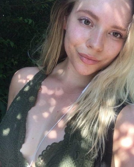 Hayatı kabusa dönmüştü! Keşfettiği besinle yeniden doğdu - Resim: 3