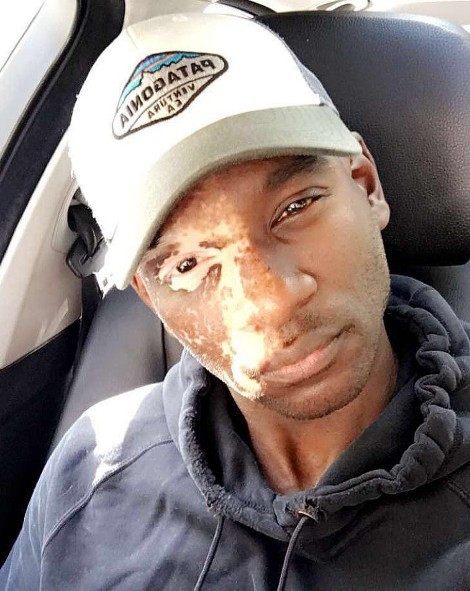 Herkes ona korkarak bakıyordu şimdi peşinden koşuyorlar - Resim: 1