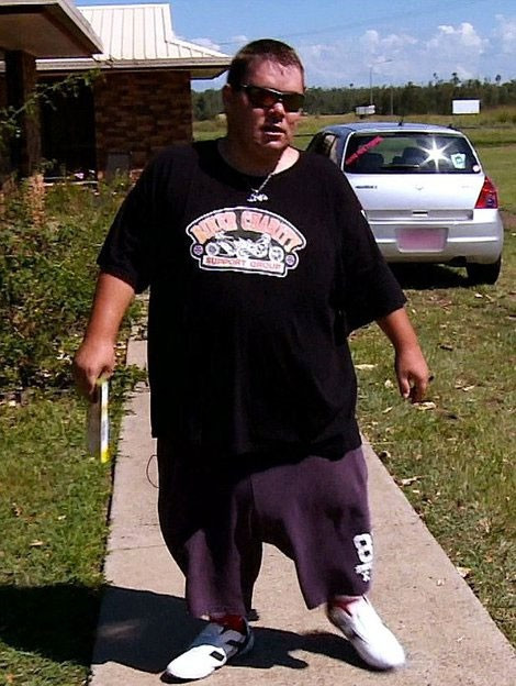 Testisleri karpuz büyüklüğünde tam 5 buçuk kilo! - Resim: 4