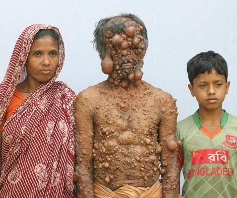 Görenler ona canavar diyor eğer tedavi edilmezse... - Resim: 3