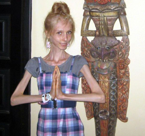 Görüntüsüyle dehşete düşürdü - Resim: 3