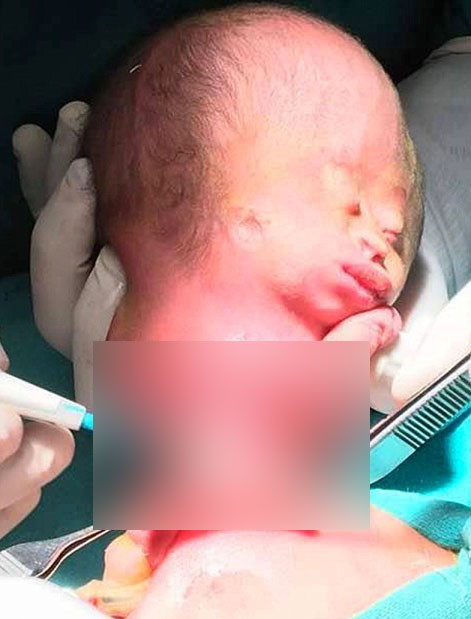 Yenidoğan bebeğin karnından çıkan doktorları şoke etti! - Resim: 4