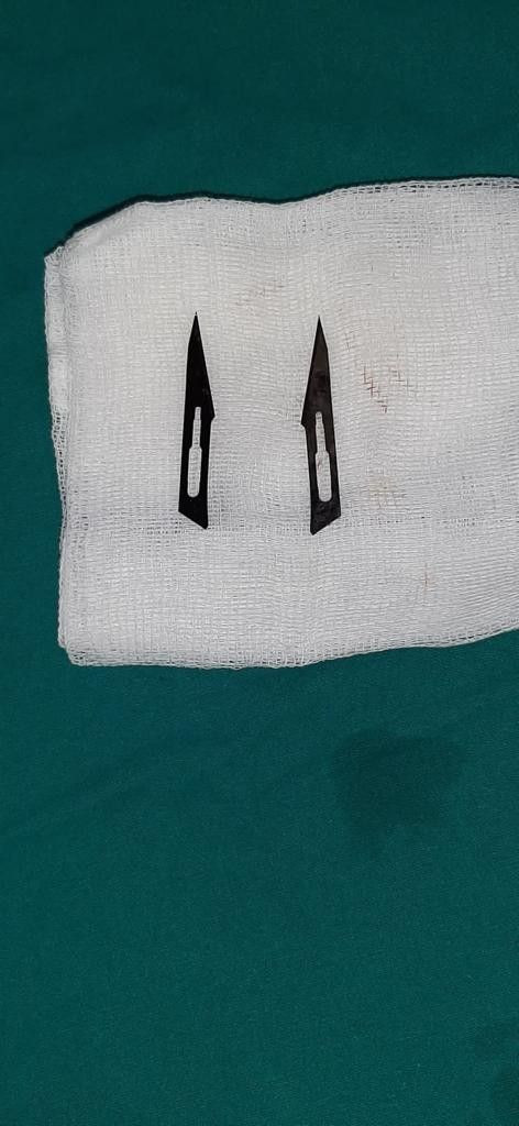 Karın ağrısı şikayetiyle gitti içinden çıkanlar doktoru dehşete düşürdü ekmekle birlikte yutmuş - Resim: 2