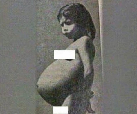 5 yaşında hamile kalıp anne olmuştu son hali ortaya çıktı! - Resim: 1