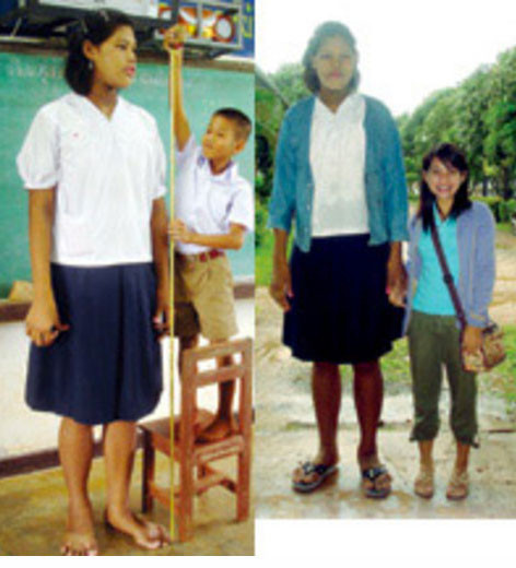 2 metre 10 santimlik dev kız - Resim: 1