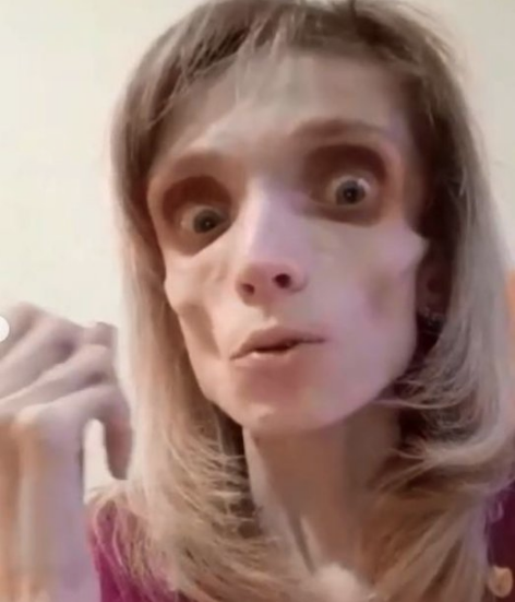 Bu kadın sadece 17 kilo! Doktoru "Korku filminde ceset rolü oynarsın" dedi - Resim: 2