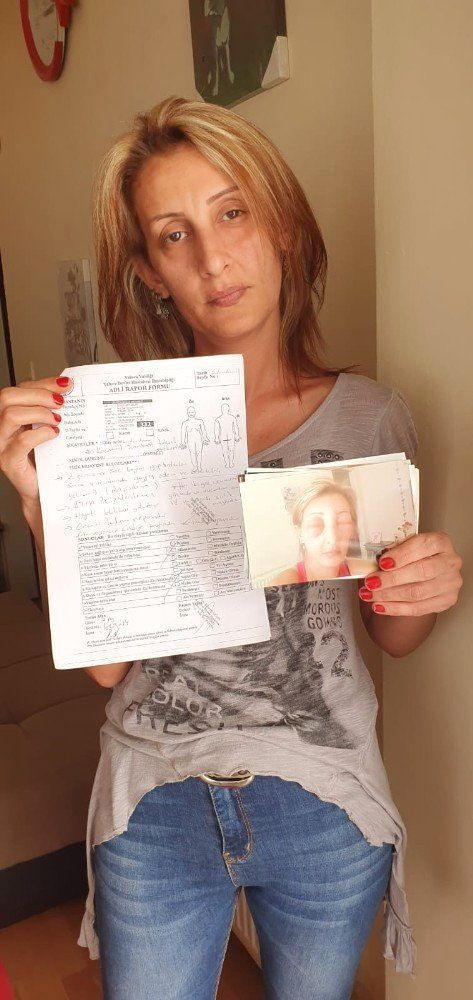 Yalova'da saçlarını yaptırmak için kuaföre gitti, az kalsın canından oluyordu - Resim: 2