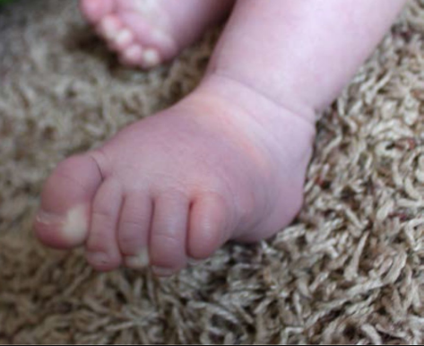 Yenidoğan bebekleri bekleyen büyük tehlike! Daha önce duymadınız - Resim: 3