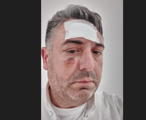 İş adamı 3 saat boyunca kabusu yaşadı! Özel hastane sahibi dövdü, pansuman yaptırıp gönderdi - Resim: 2