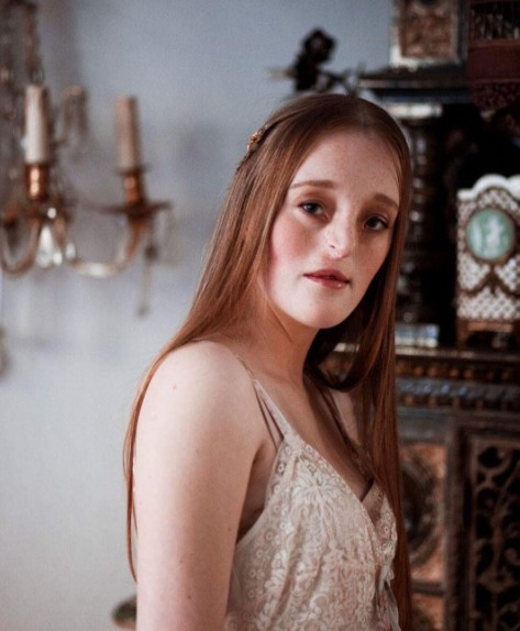 16 yaşındayken bağırsakları alındı 7 yıl sonra ise... - Resim: 3