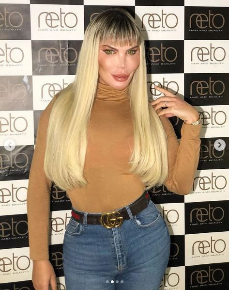 Ken Bebek lakaplı Rodrigo Alves yaptırdığı botokslar sonucu cinsiyet değiştirdi! - Resim: 1