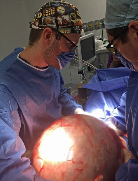 Doktorlar kadının karnını görünce inanamadı - Resim: 4