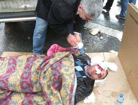 TEM'de can pazarı - Resim: 1