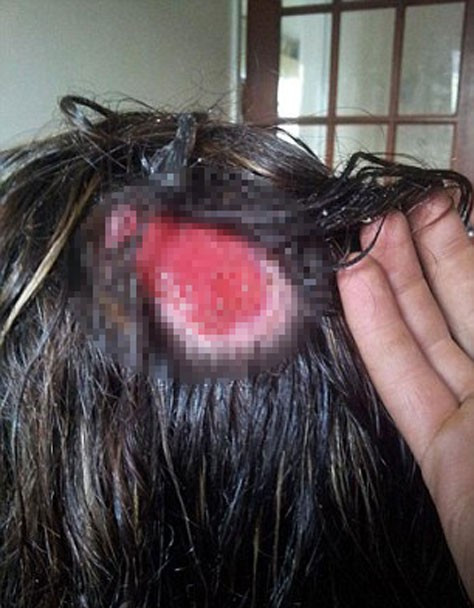 Kuaför hatası bakın ne yaptı korkunç! - Resim: 3