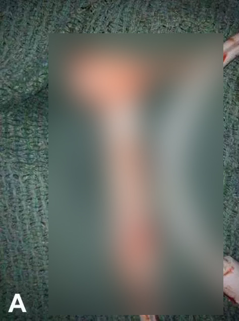 'Duşta kayıp üzerine düştüm' dedi doktorlar görünce gözlerine inanamadı - Resim: 2