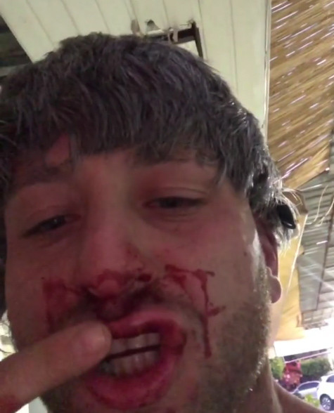 Survivor Taner Tarlacı kafayı sıyırmış fena dayak yedi bakın ne paylaştı - Resim: 3