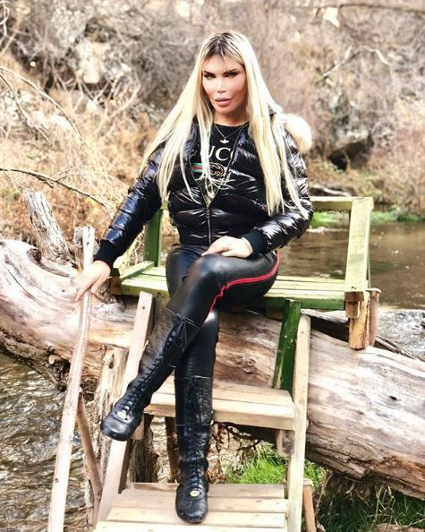 Ken Bebek lakaplı Rodrigo Alves yaptırdığı botokslar sonucu cinsiyet değiştirdi! - Resim: 3