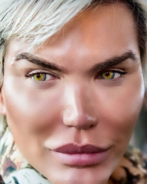 Amacı Barbie bebeğe benzemekti ama yüzü haşlandı son hali şok - Resim: 2