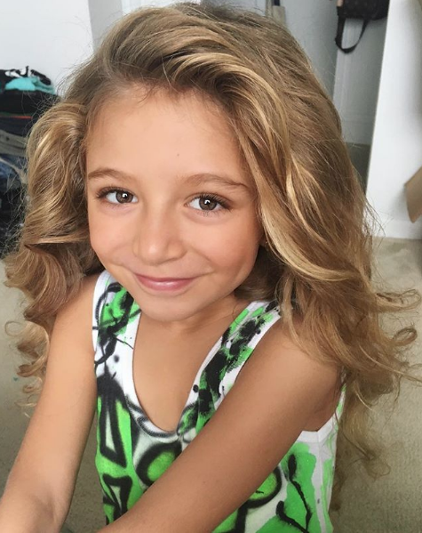 Böylesinin eşi benzeri yok 7 yaşındaki kız her güldüğünde... - Resim: 2