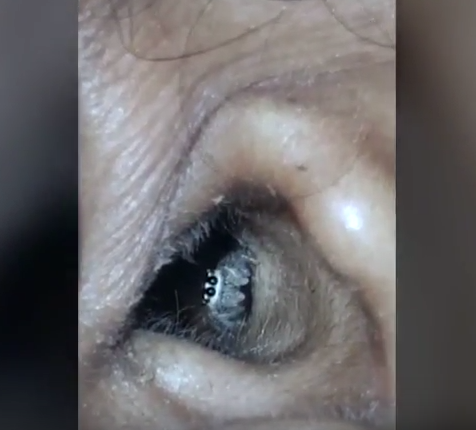 Kulaklarından öyle şeyler çıktı ki görenler hayret etti - Resim: 4