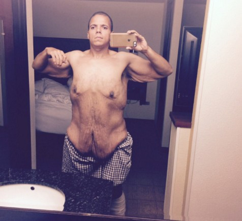 Vücutlarının yarısı gitti - Resim: 3