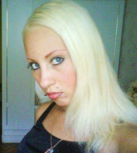 Botoksla gelen korkunç değişim! - Resim: 2