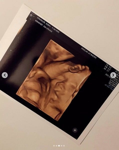 Eser Yenenler'in eşi Berfu Yenenler paylaştı 'Burnu yine sana benziyor kocacığım' - Resim: 4