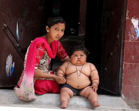 Bu bebek 8 aylık! 4 yaşındaki çocukla aynı kiloda - Resim: 1