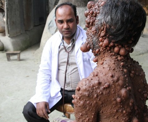 Görenler ona canavar diyor eğer tedavi edilmezse... - Resim: 1