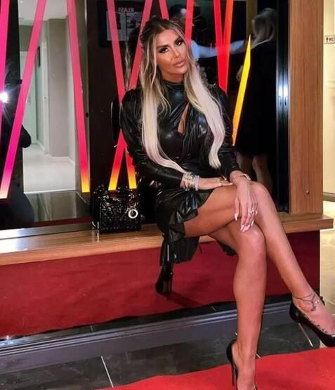 Adanalı'nın yıldızı estetikle bambaşka birine dönüştü eleştirilere yanıt verdi - Resim: 3