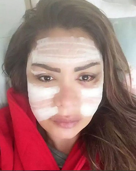 Sevda Demirel perişan halde ekrana pijamayla çıktı ve... - Resim: 2