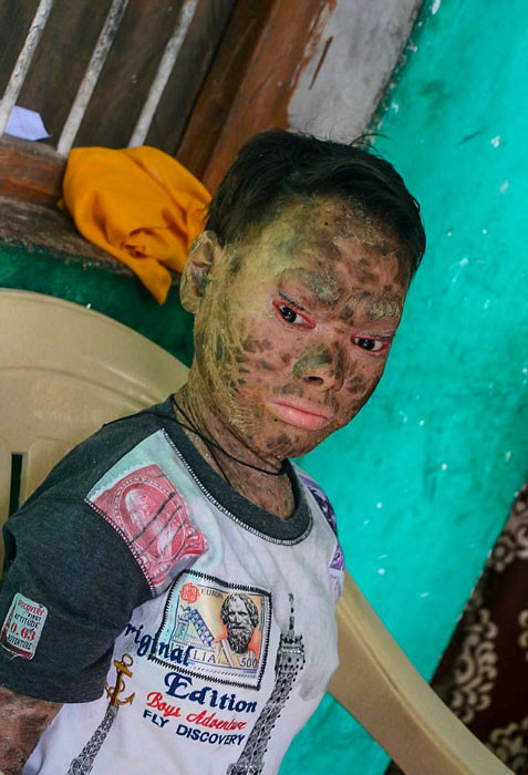 Dünya onu konuşuyordu yılan kızın son haline bakın - Resim: 1