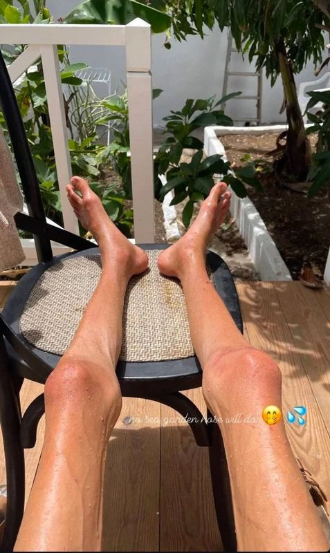 22 kiloya kadar düşmüştü! Sosyal medya fenomeni kaldığı otelde hayatını kaybetti - Resim: 2