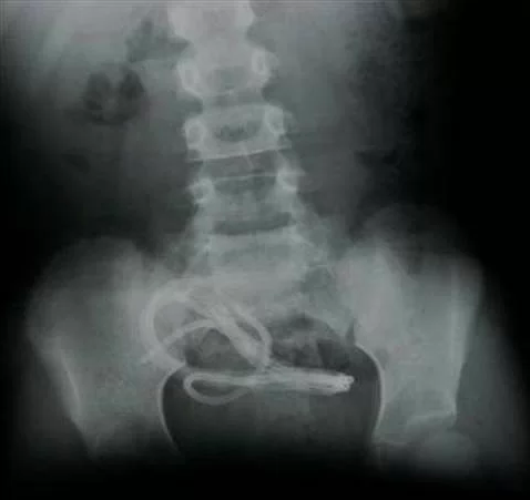 Türklere mahsus en ilginç ölümler - Resim: 2