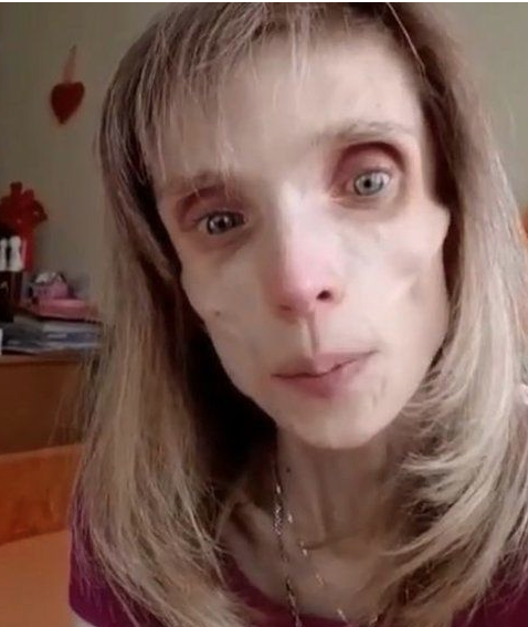 Bu kadın sadece 17 kilo! Doktoru "Korku filminde ceset rolü oynarsın" dedi - Resim: 4