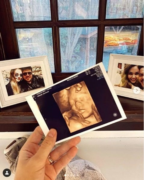 Eser Yenenler'in eşi Berfu Yenenler paylaştı 'Burnu yine sana benziyor kocacığım' - Resim: 2