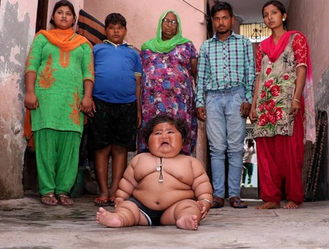 Bu bebek 8 aylık! 4 yaşındaki çocukla aynı kiloda - Resim: 4