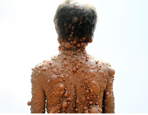 Görenler ona canavar diyor eğer tedavi edilmezse... - Resim: 4