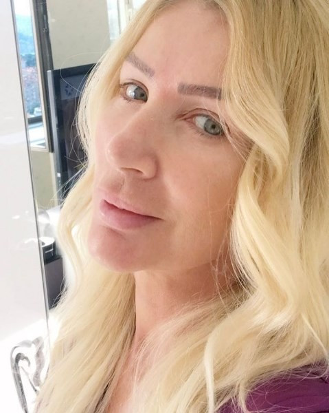 Seda Sayan'ın estetikli hali fiyasko mu? - Resim: 3