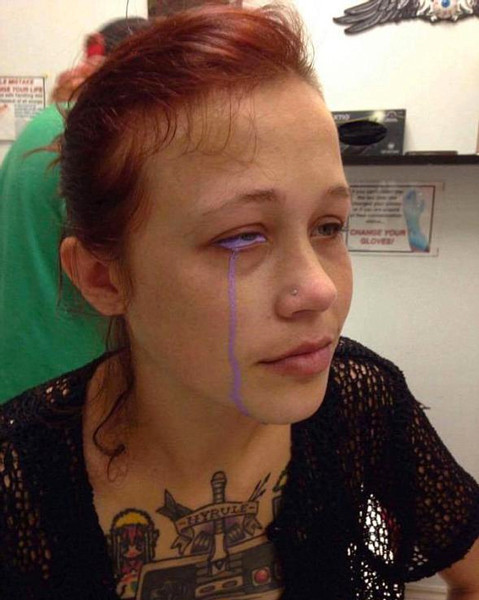 Gözü bir anda bu hale geldi doktorlar hayrete düştü - Resim: 1