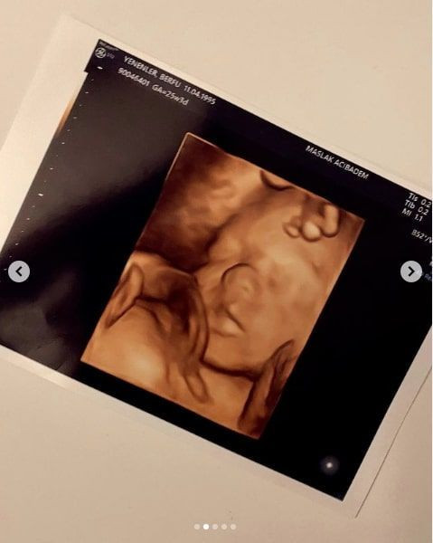 Eser Yenenler'in eşi Berfu Yenenler paylaştı 'Burnu yine sana benziyor kocacığım' - Resim: 3